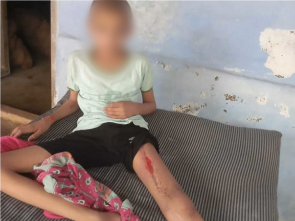 Support Jaydeep Manoj Bhai Pandit Recover From Bone Cancer