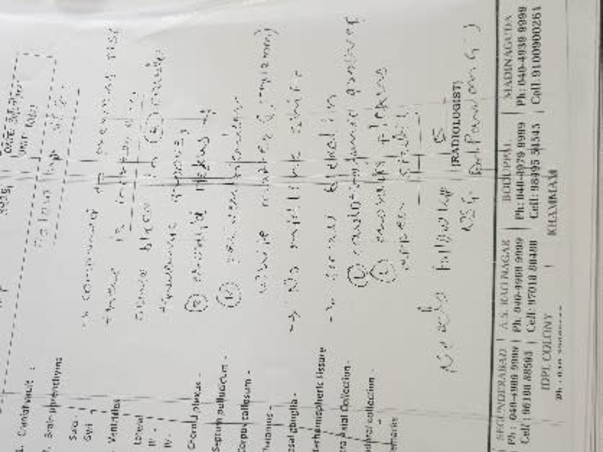 Help New Born Twins to fight Extreme preterm AGA RDS Intraventricular