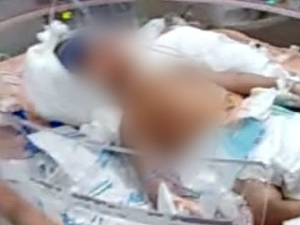 Support Baby Of Meena Recover From Heart Disease And CDH Issue