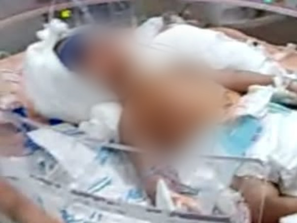 Support Baby Of Meena Recover From Heart Disease And CDH Issue