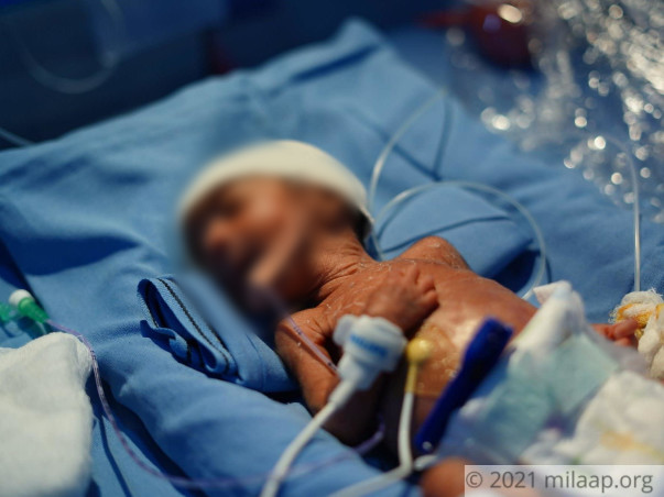 Help my son fight Prematurity