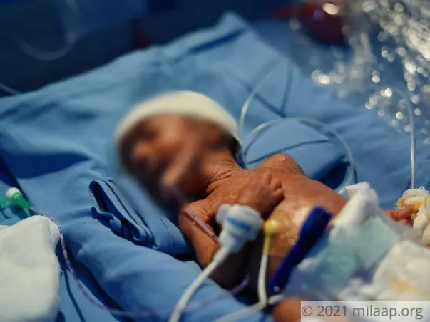 Help my son fight Prematurity