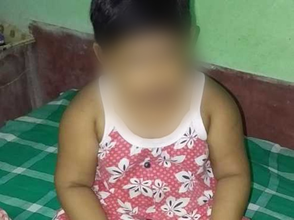5 Years Old Snehoshi Ganguly Needs Your Help To Recover From ROHHAD(NET) Syndrome
