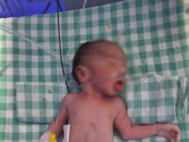 Help My Baby Boy Recover From Inguinal Hernia