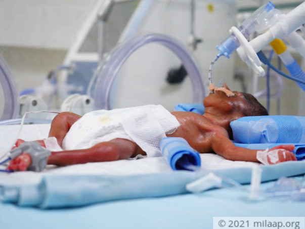 This Poor Mother Struggles Alone To Save Her Premature Twin Babies