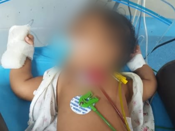 Support Koviniyan Recover From Propionic Acidemia