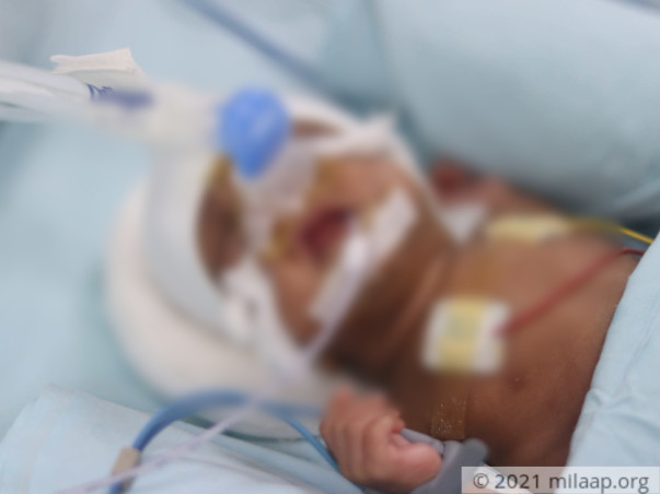 help-baby-of-r-aparna