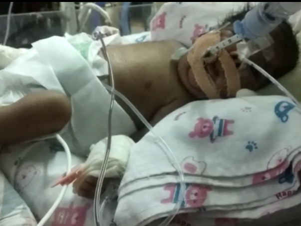 Pre-mature Baby Need Immediate Funds For Treatment Of Life Threatening