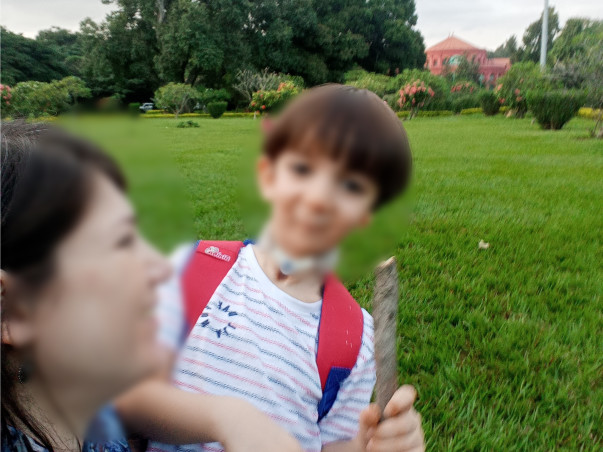 Help avyaan to remove his tracheostomy tube