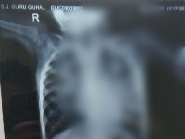 Support 2 Year Old Guru Guhn Undergo Cardiac Surgery