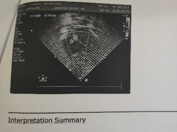 1 Month Old Mani Needs Your Help To Recover From Heart Disease