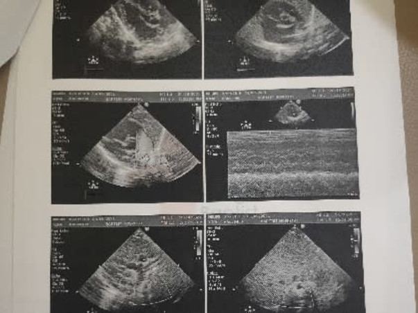 1 Month Old Mani Needs Your Help To Recover From Heart Disease