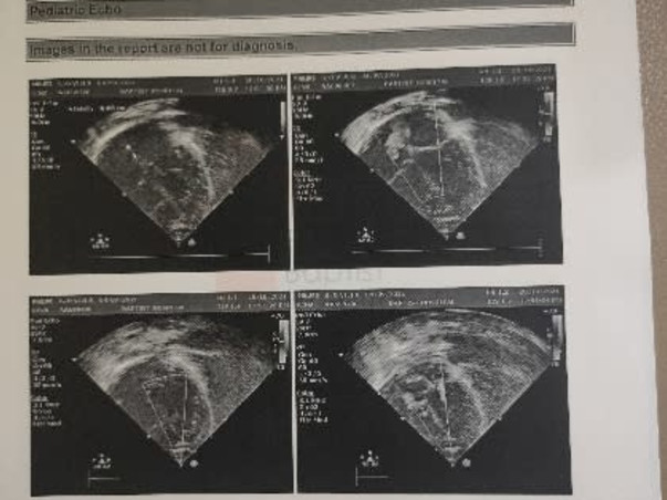 1 Month Old Mani Needs Your Help To Recover From Heart Disease