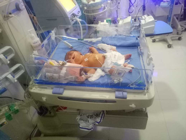 10 days old syed ali needs your help fight Lung infection, Dextrocardia (right side heart), his father is a poor man and works as a scooter mechanic