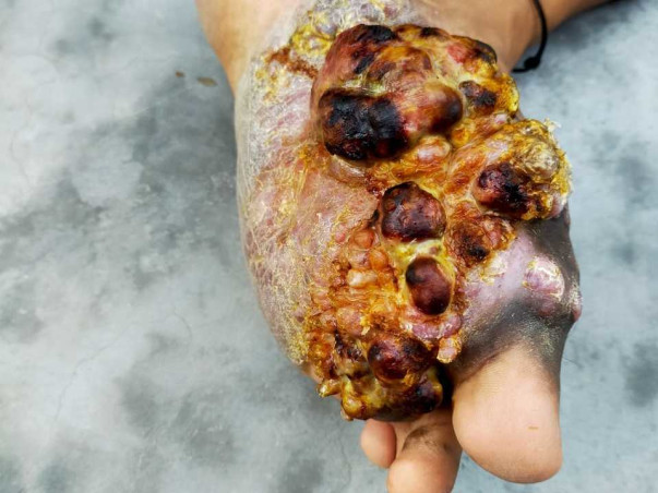 Help Golu Walk Again