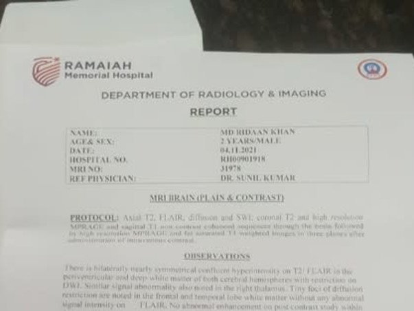 2 years Old Mohammad  Ridaan Khan Needs Your Help To Recover From  Brain Infection