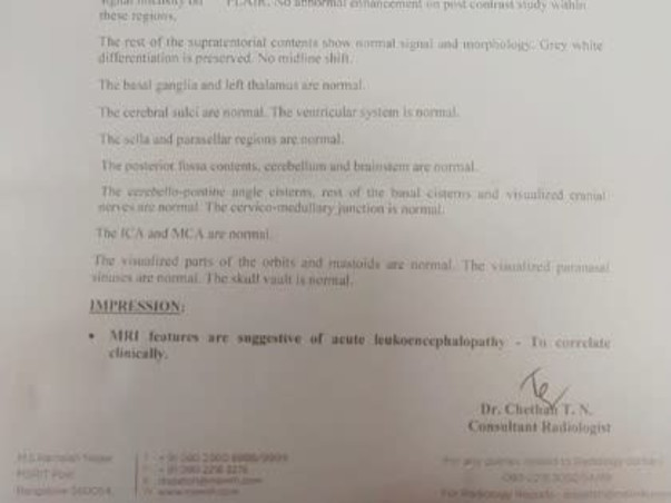 2 years Old Mohammad  Ridaan Khan Needs Your Help To Recover From  Brain Infection