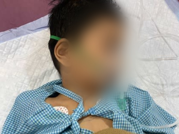 2 years Old Mohammad  Ridaan Khan Needs Your Help To Recover From  Brain Infection