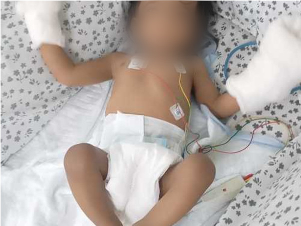 Support B Mokishta To Recover From Heart Problem