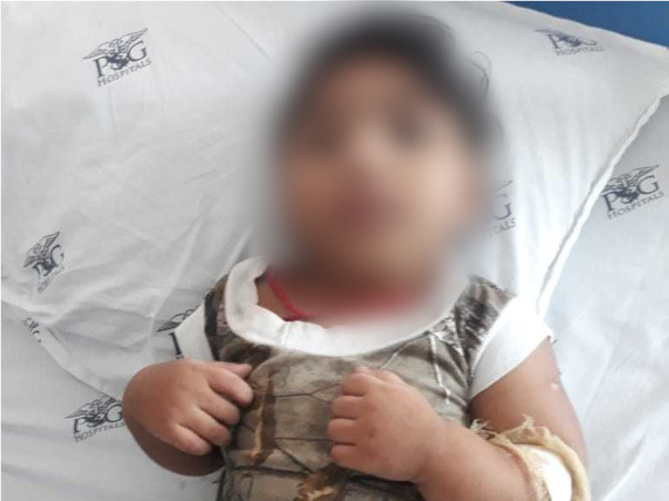 1-Year-Old Muthra Needs Your Help To Undergo Gastrostomy