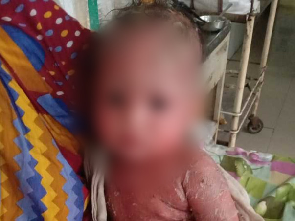 Ur small contribution can save the child...