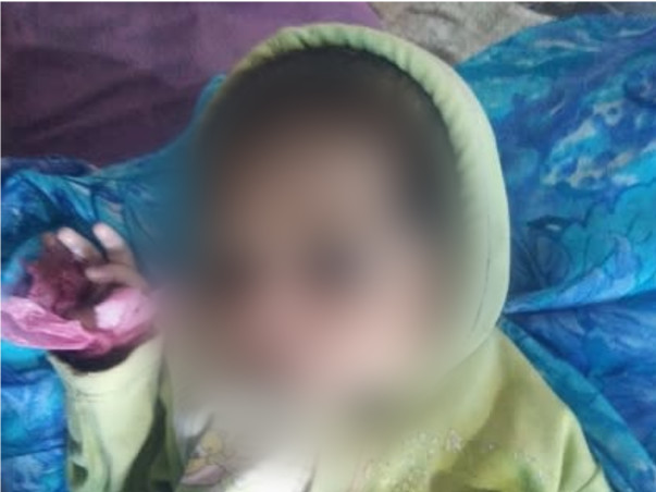 4 Months Old Harsha Needs Your Help To Recover From Heart Disease