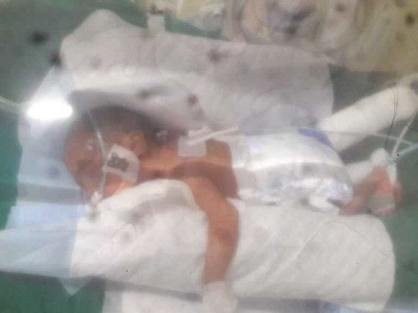 7 days old Baby of Gowri needs your help To Recover Premature