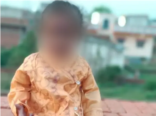 2 Years Old Rahul Pal Needs Your Help Undergo Open Heart Surgery