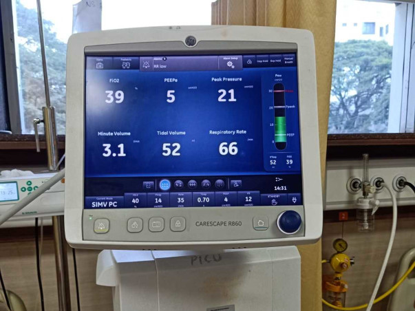 2 Months Old Anfa Khanam Needs Your Help To Recover From Lungs Infection, Pneumonia And Epilepsy