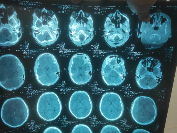 13 Years Old Sujal Kumar Needs Your Help To recover From Brain Injury