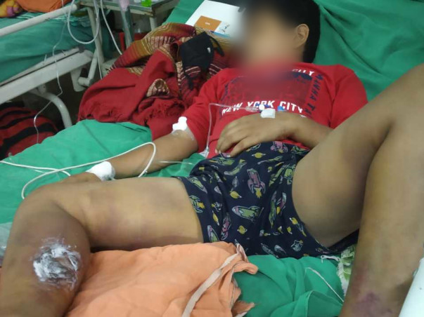 Help my son fight Vascular Disease in both leg