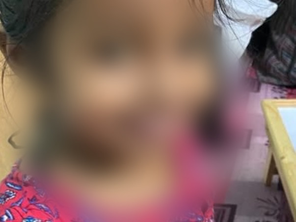 4 Years Old Zahra Needs Your Help for Liver transplant