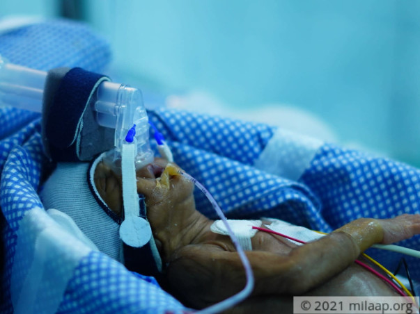 help-baby-of-deepthi-k