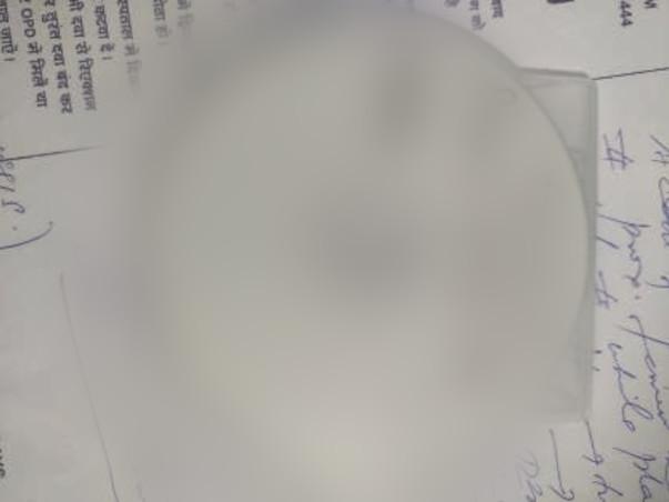 Help My Daughter To Recover From Leg Infection