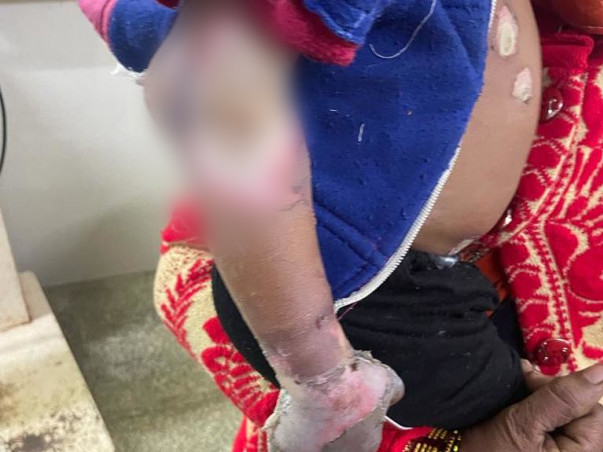 Help My Son To Recover From Electric Shock Accident