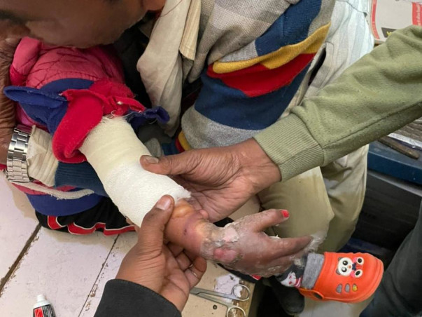 Help My Son To Recover From Electric Shock Accident