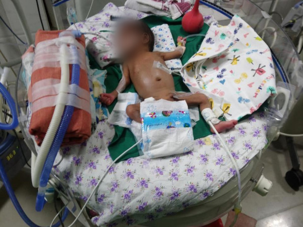Help My Son To Fight Prematurity