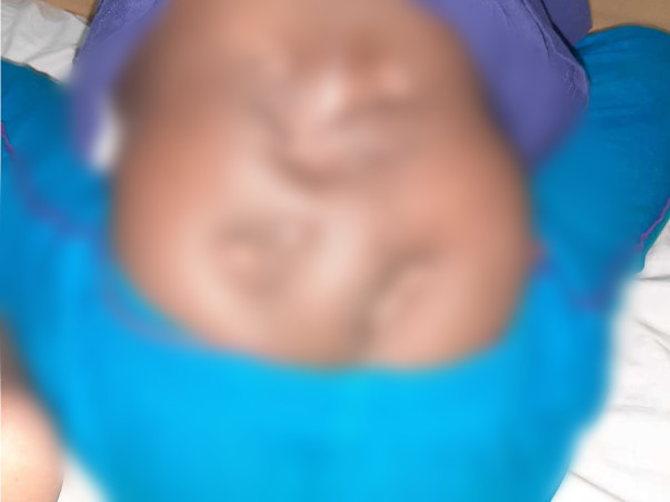 Support Mohith Sai Aman To Recover Spinal Deformity