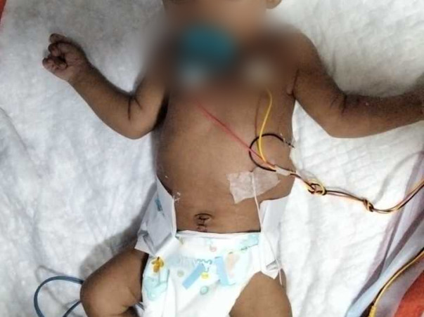 SUPPORT THIS 2 MONTHS OLD TO FIGHT WITH BREATHING AND KIDNEY PROBLEM