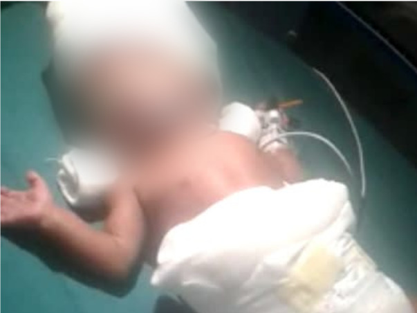 4 Months Old Baby Of Santosh Needs Your Help Fight Preterm Complicatio