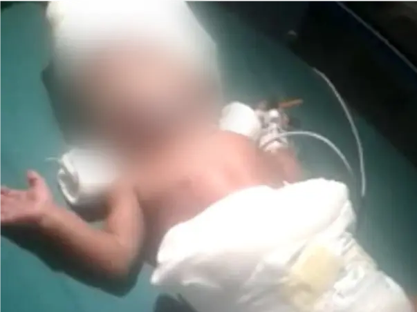 4 Months Old Baby Of Santosh Needs Your Help Fight Preterm Complicatio