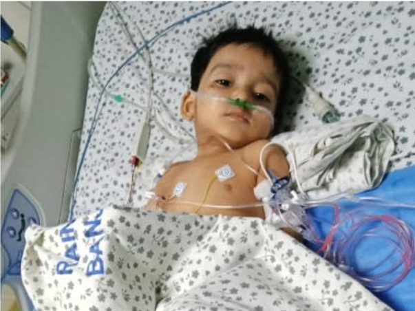 Please Support My Son - Mohd Umer To Undergo His Treatment And Recover