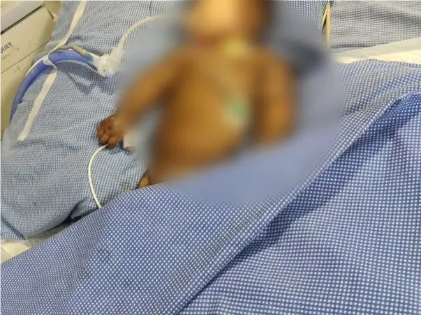 4 Months Old K Hayan Needs Your Help To Recover From Heart Problem
