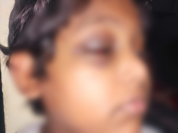 Fundraiser for 10 yr old boy suffering with Hemophilia(blood bleeding)