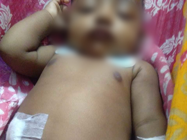 Support 5 Months Old Dripto Das To Undergo Liver Transplant...