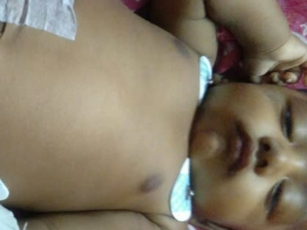 Support 5 Months Old Dripto Das To Undergo Liver Transplant...