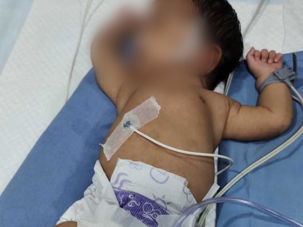 Help New Born Baby To recover from Heart Disease