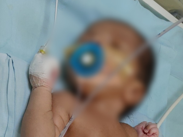 Support Baby Of Divya To Recover From Congenital Diaphragmatic Hernia
