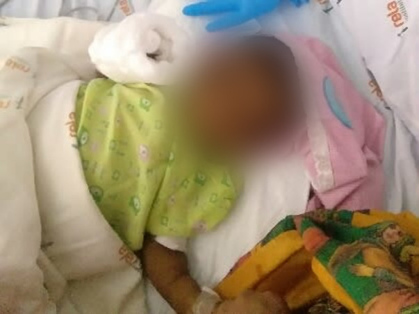Support 5 Months Old Dripto Das To Undergo Liver Transplant...