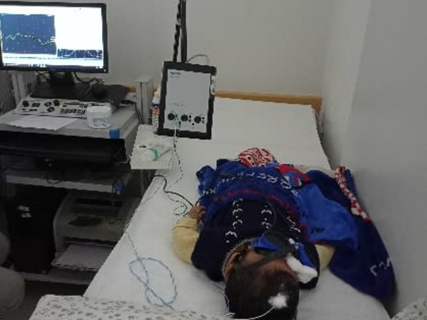 Brain Infection due to CMV